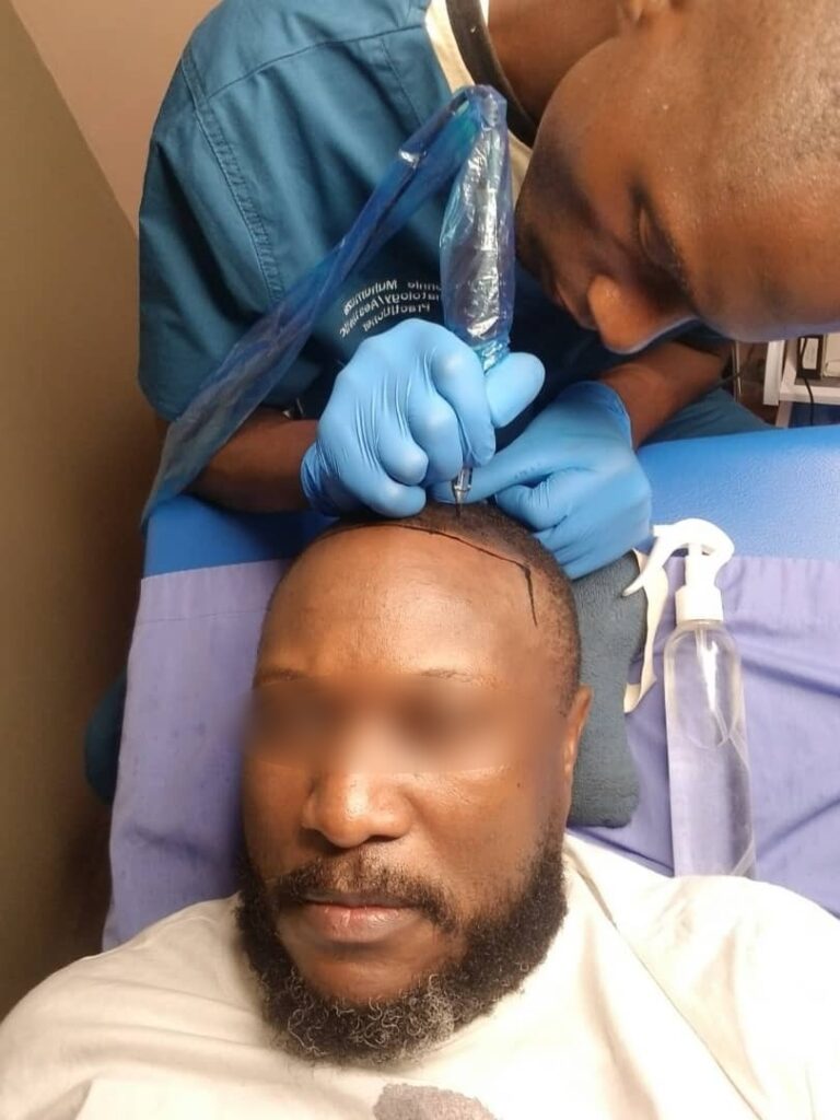 a man during a session of smp treatment with dermatologist